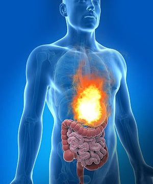 Natural Home Remedies For Acid Reflux